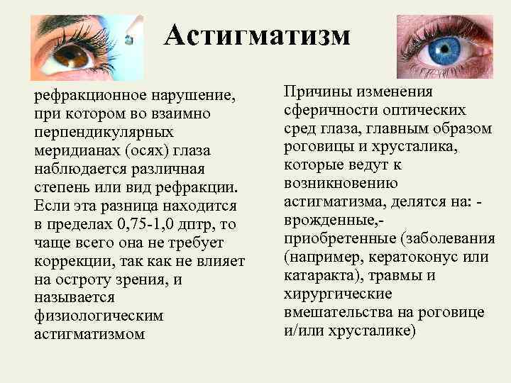 Астигматизм у детей