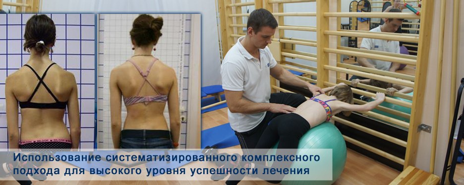 Лфк при сколиозе - комплекс лучших упражнений