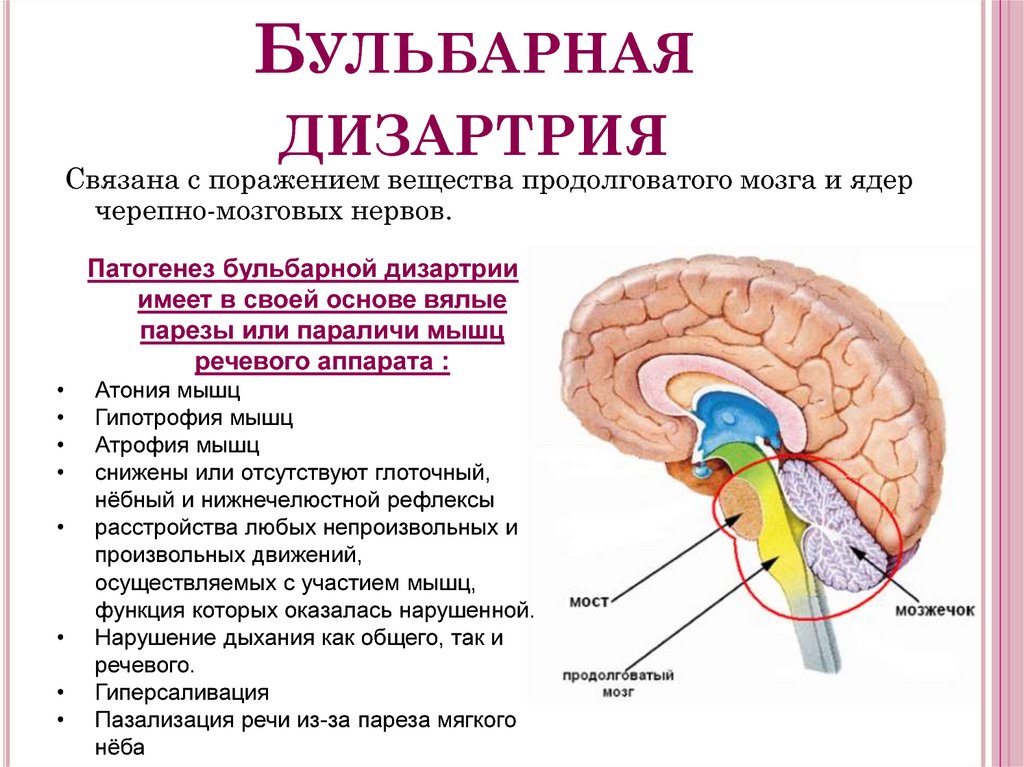Лечение дизартрии у ребенка — 8 (499) 110-13-71