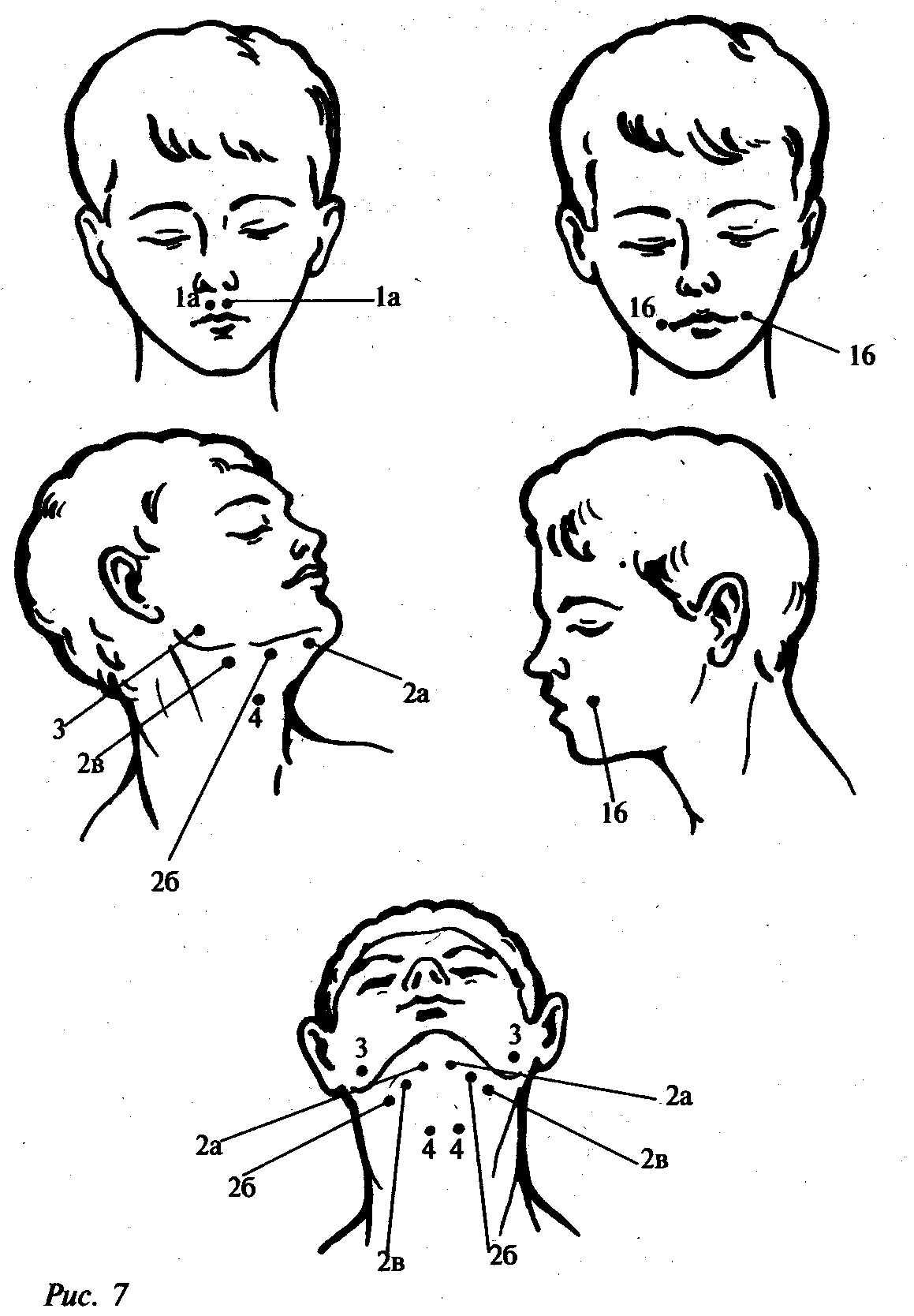 Логопедический массаж при дизартрии