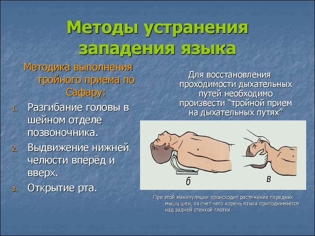Девиация языка это отклонение языка в какую либо сторону вправо или влево от срединной линии тела