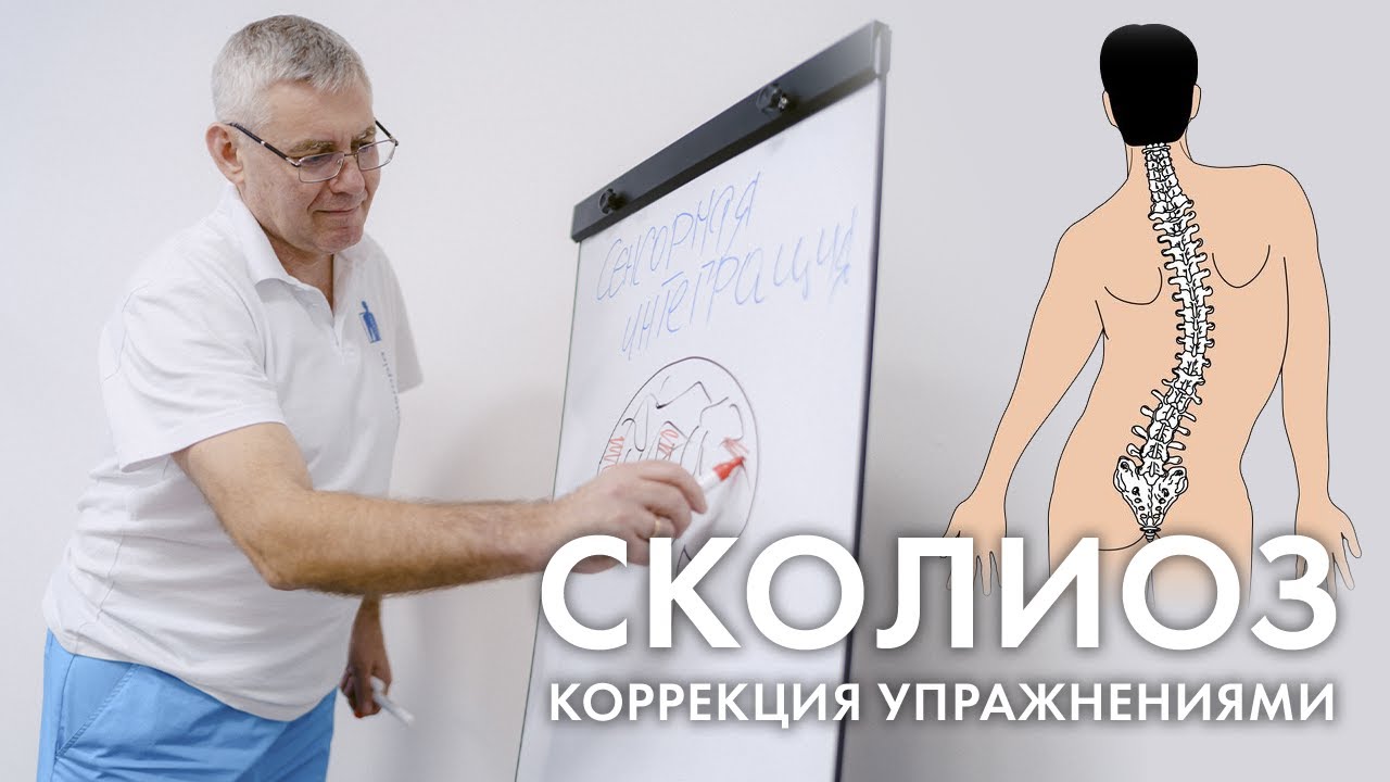 Комплекс упражнений лфк при сколиозе