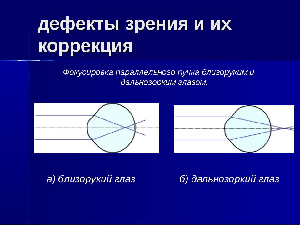 Дети с нарушениями зрения - классификация, причины и лечение