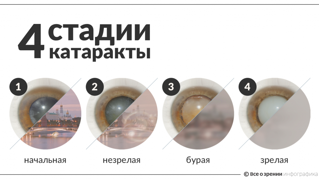 Дидактические игры
для обучающихся с нарушением зрения | коррекционная работа в школе  | учительский журнал