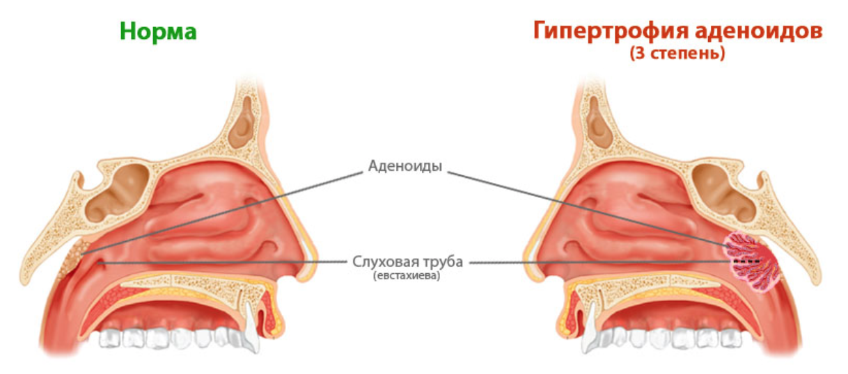 Логопедическая группа в детском саду - хорошо или плохо? кто ходил - поделитесь опытом. - я happy mama
