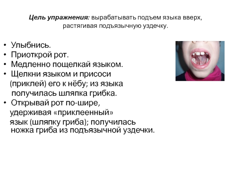 Растягивание подъязычной связки (уздечка языка)