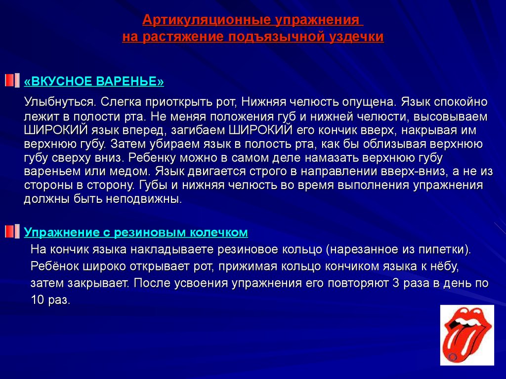 Какие существуют методы для растягивания уздечки языка у ребенка