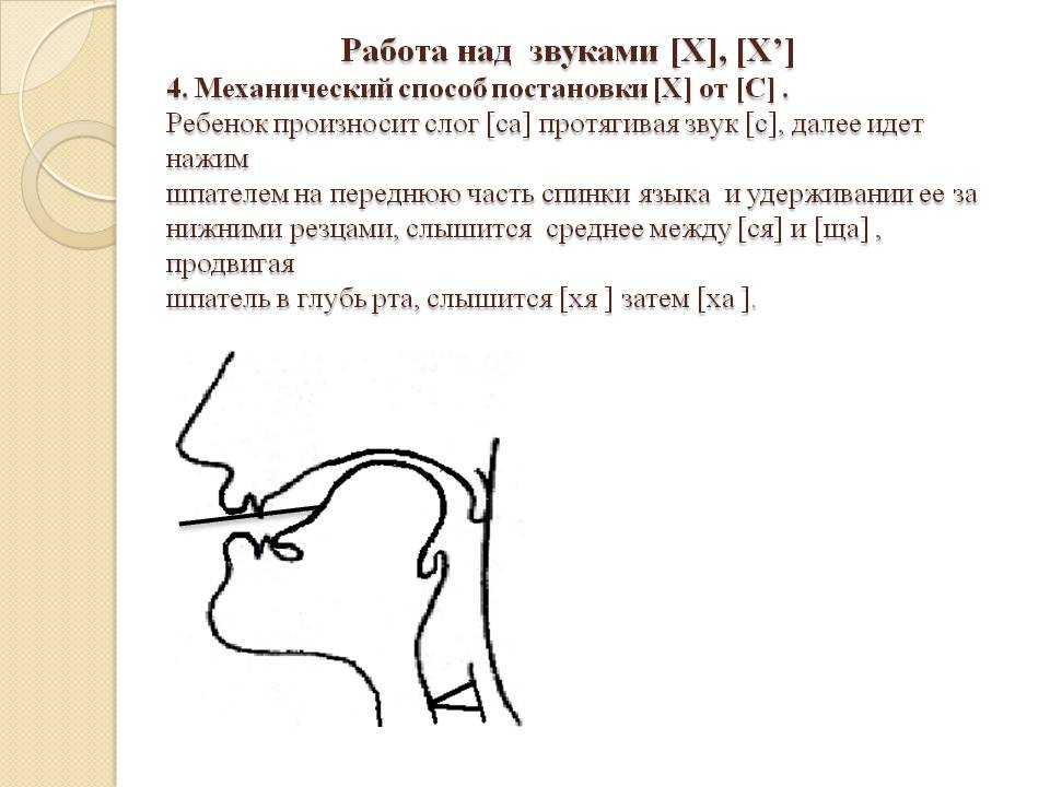 Способы постановки звука [с]