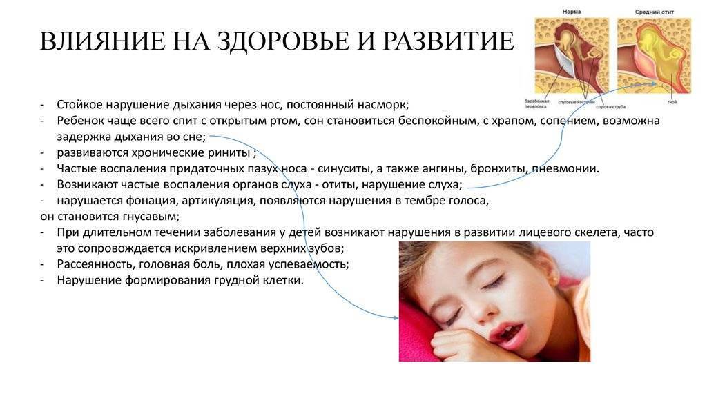 Признаки энцефалопатии головного мозга у детей и лечение