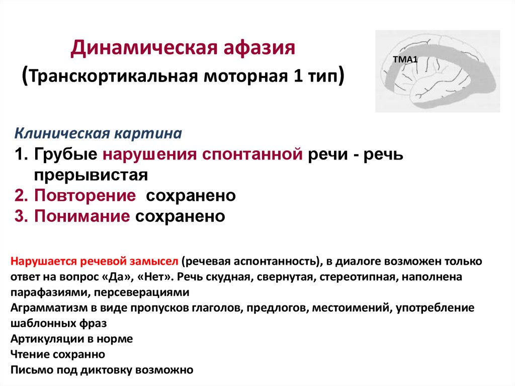 Классификация афазий