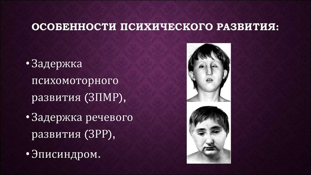 Задержка моторного развития у детей
