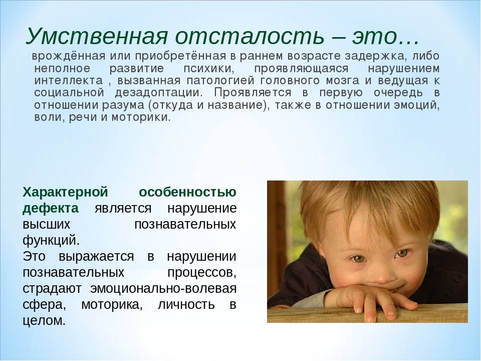 Особенности психического развития детей с синдромом дауна