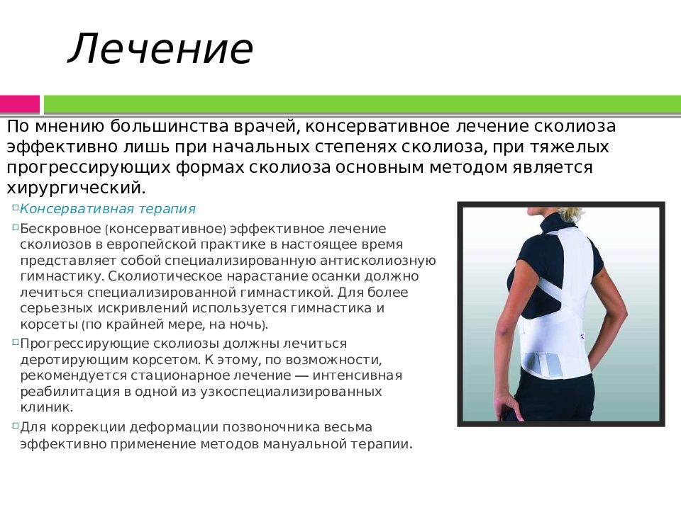 Такой разный сколиоз