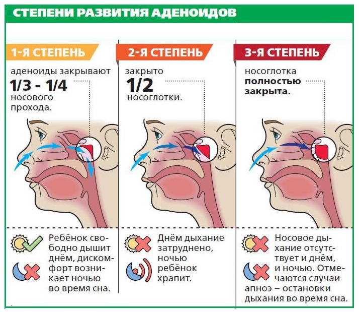 После замены хрусталика глаза