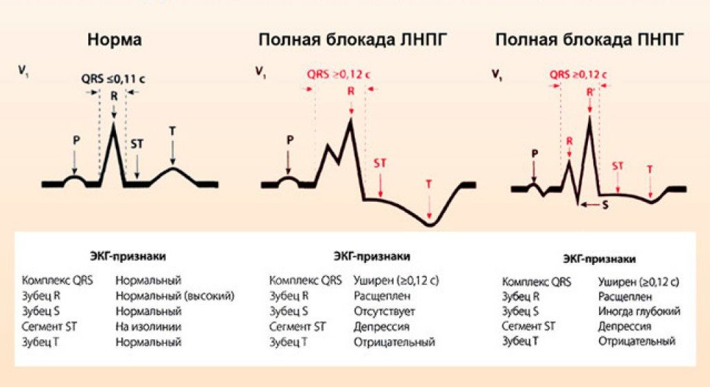 Эдипов конфликт и три гениальных фильма о нём