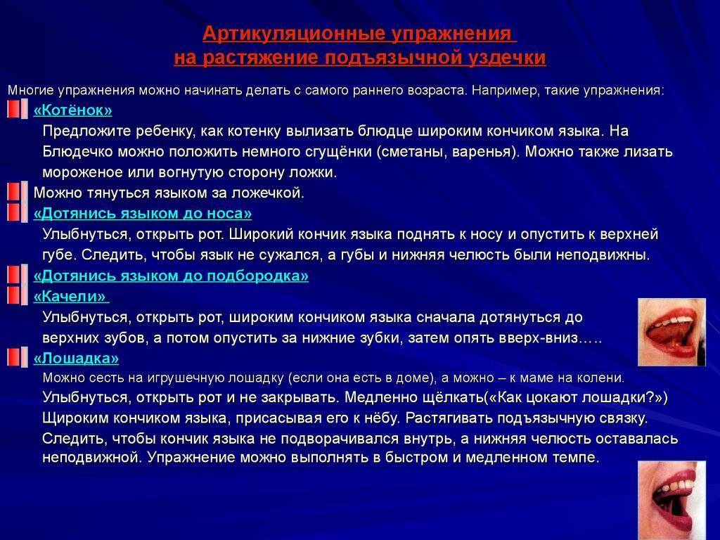 Как определить короткую уздечку языка у ребенка и нужно ли подрезать