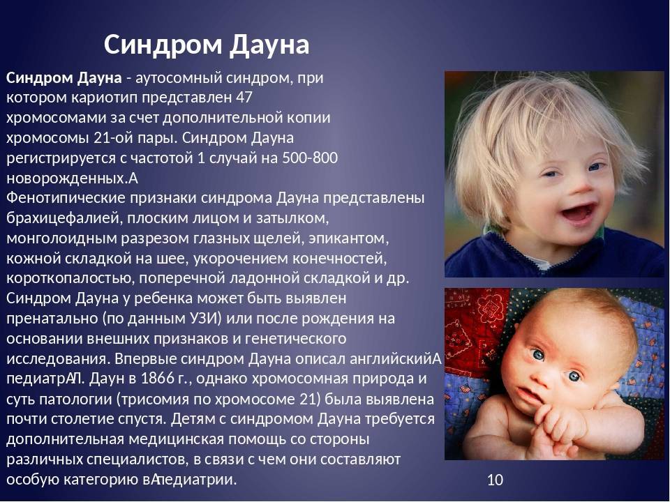 Синдром дауна: риск, причины, признаки при беременности