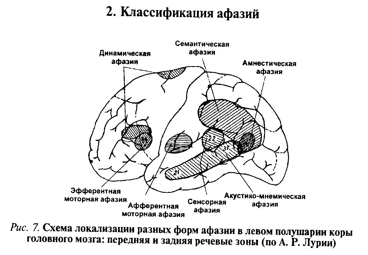 Афазия у детей, её проявления и причины формирования