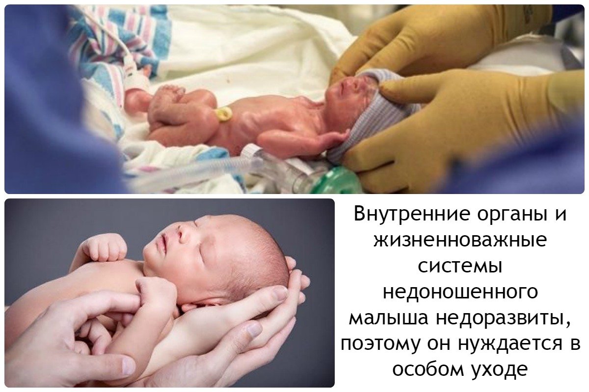 Анатомо-физиологические особенности новорожденных