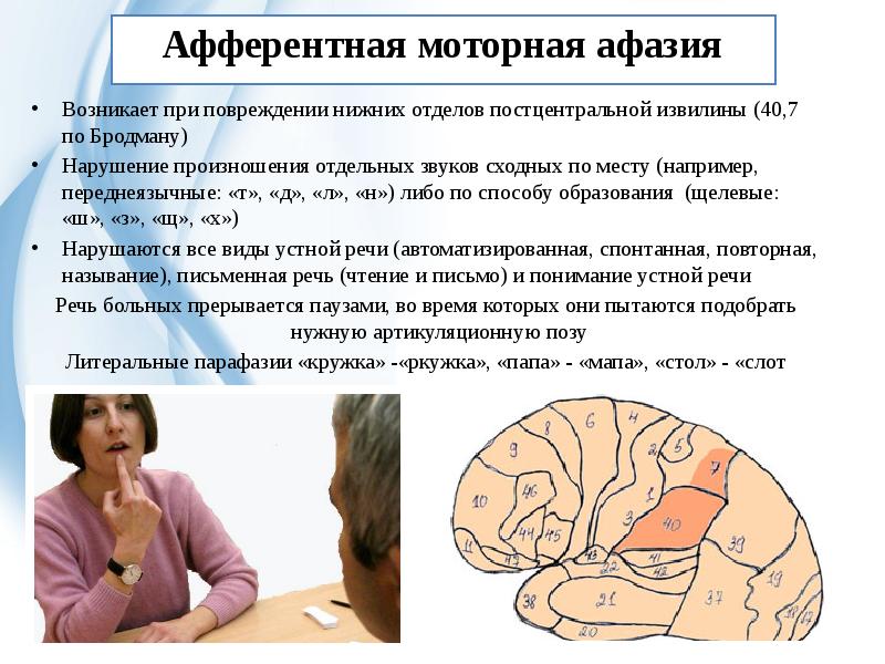 Характеристика различных форм дизартрии. воспитателям детских садов, школьным учителям и педагогам - маам.ру