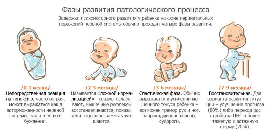 Массаж при неврологических заболеваниях - особенности