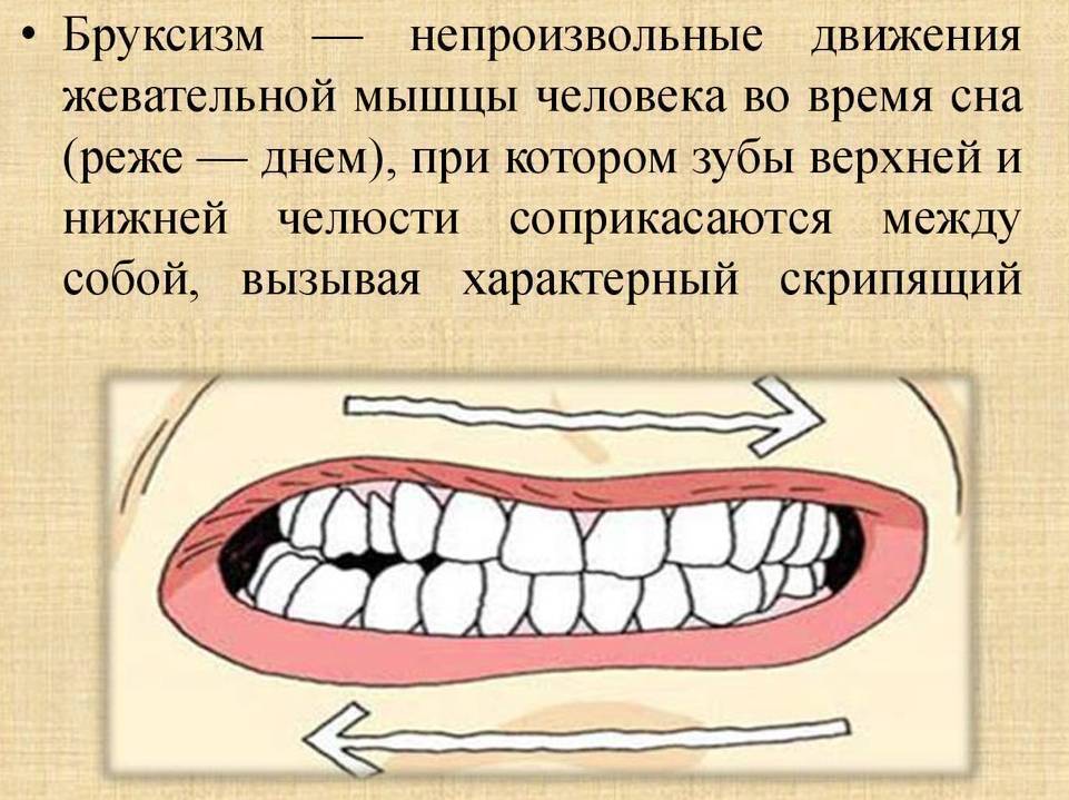 Почему ребенок во сне скрипит зубами (бруксизм): причины и лечение