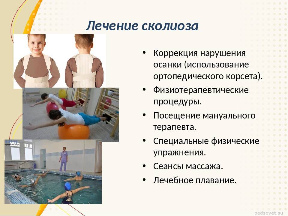 Нарушение осанки у детей и взрослых, профилактика, взаимосвязь с плоскостопием и сколиозом
