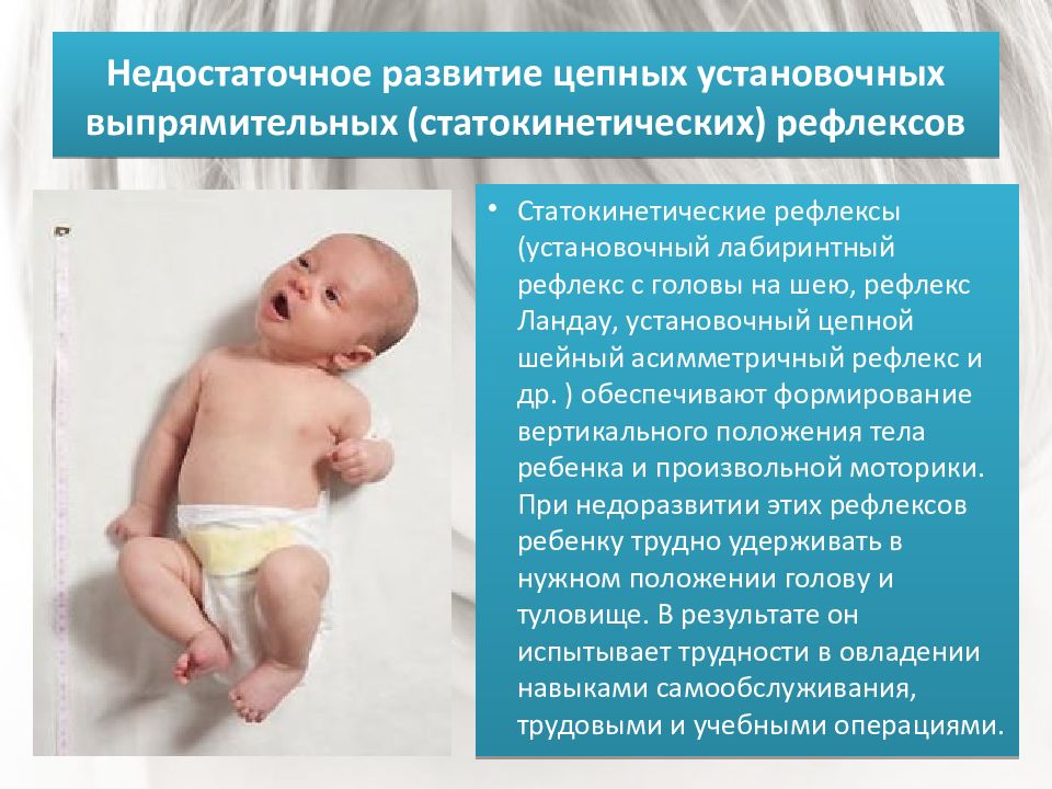 Детский церебральный паралич (дцп): причины, симптомы, прогноз жизни и лечение заболевания