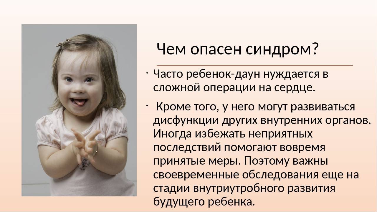 Синдром дауна: мифы и реальность | advlab.ru - лаборатория рекламы, маркетинга и pr