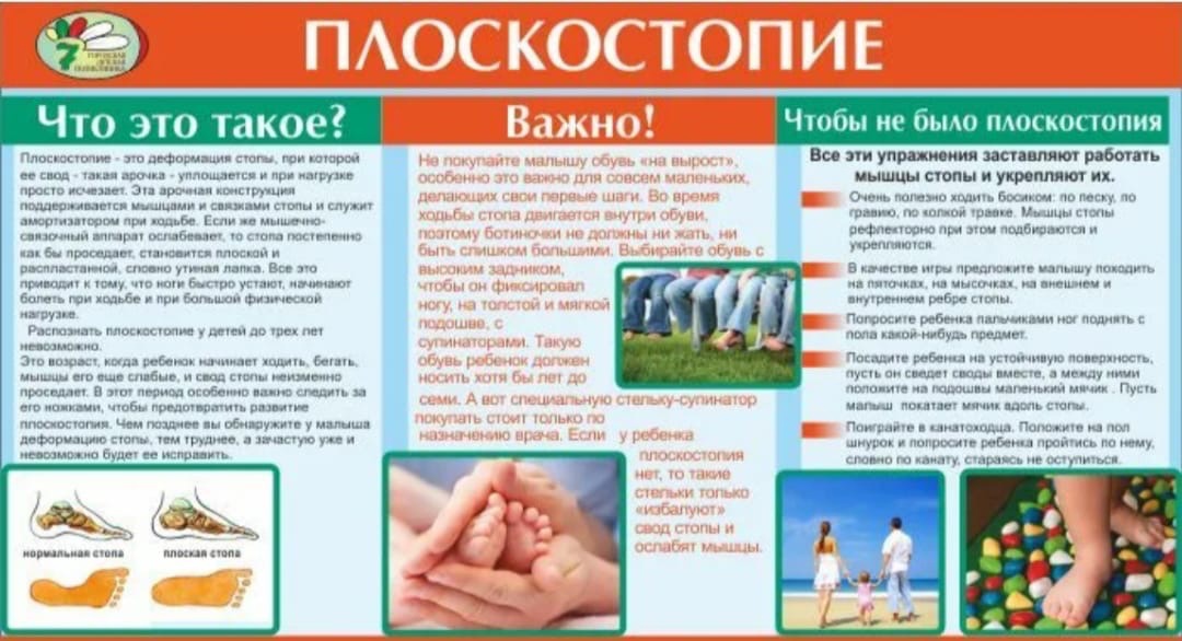 Профилактика плоскостопия у детей
