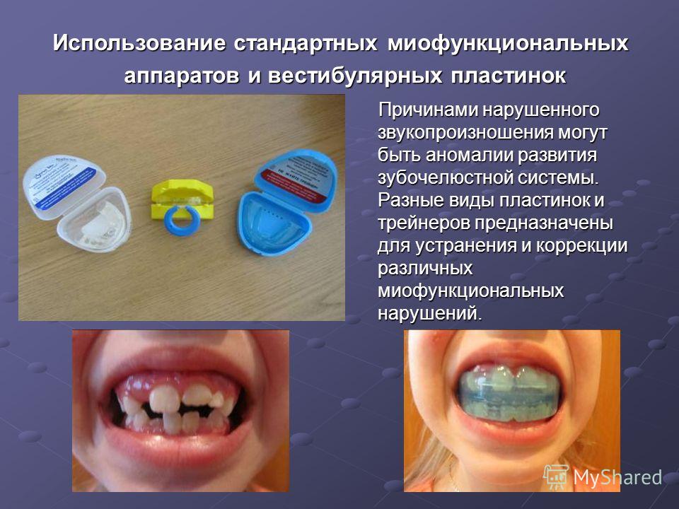 Логопедический массаж зондами: методика проведения
