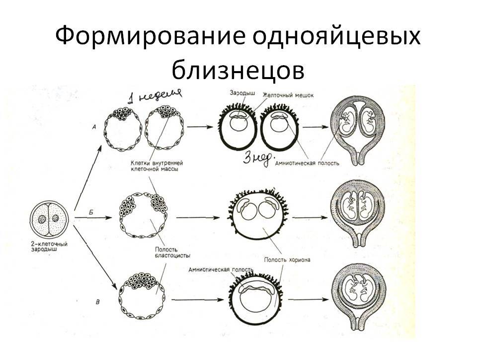 Большая разница — близнецы или двойняшки?