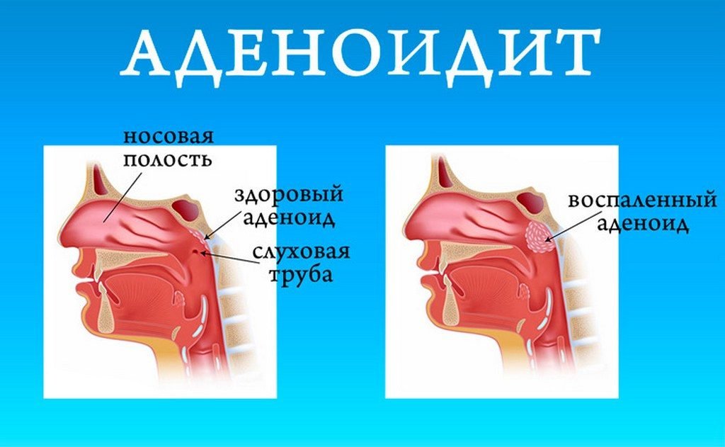 Актуальные проблемы, состояние и перспективы развития логопедической службы в мбдоу «детский сад № 188» г. о. самара | статья в журнале «молодой ученый»