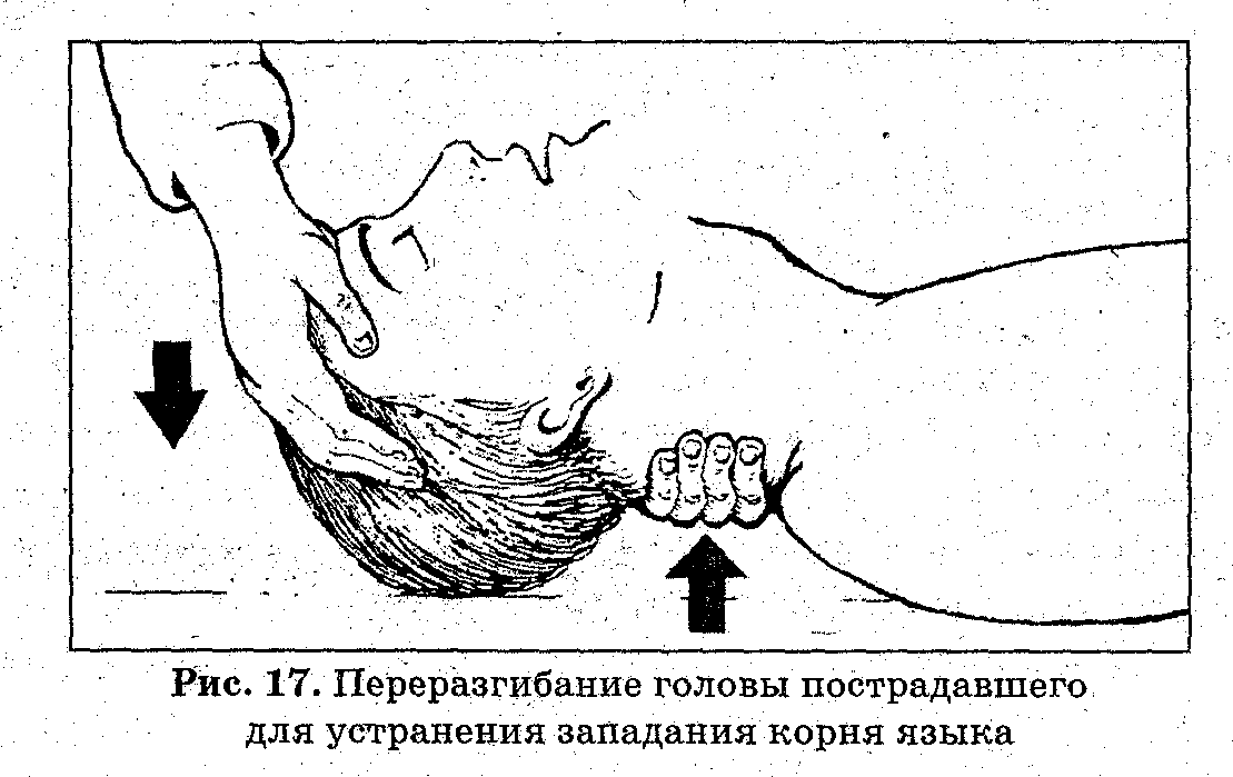 Девиация языка вправо: что это означает и как лечить